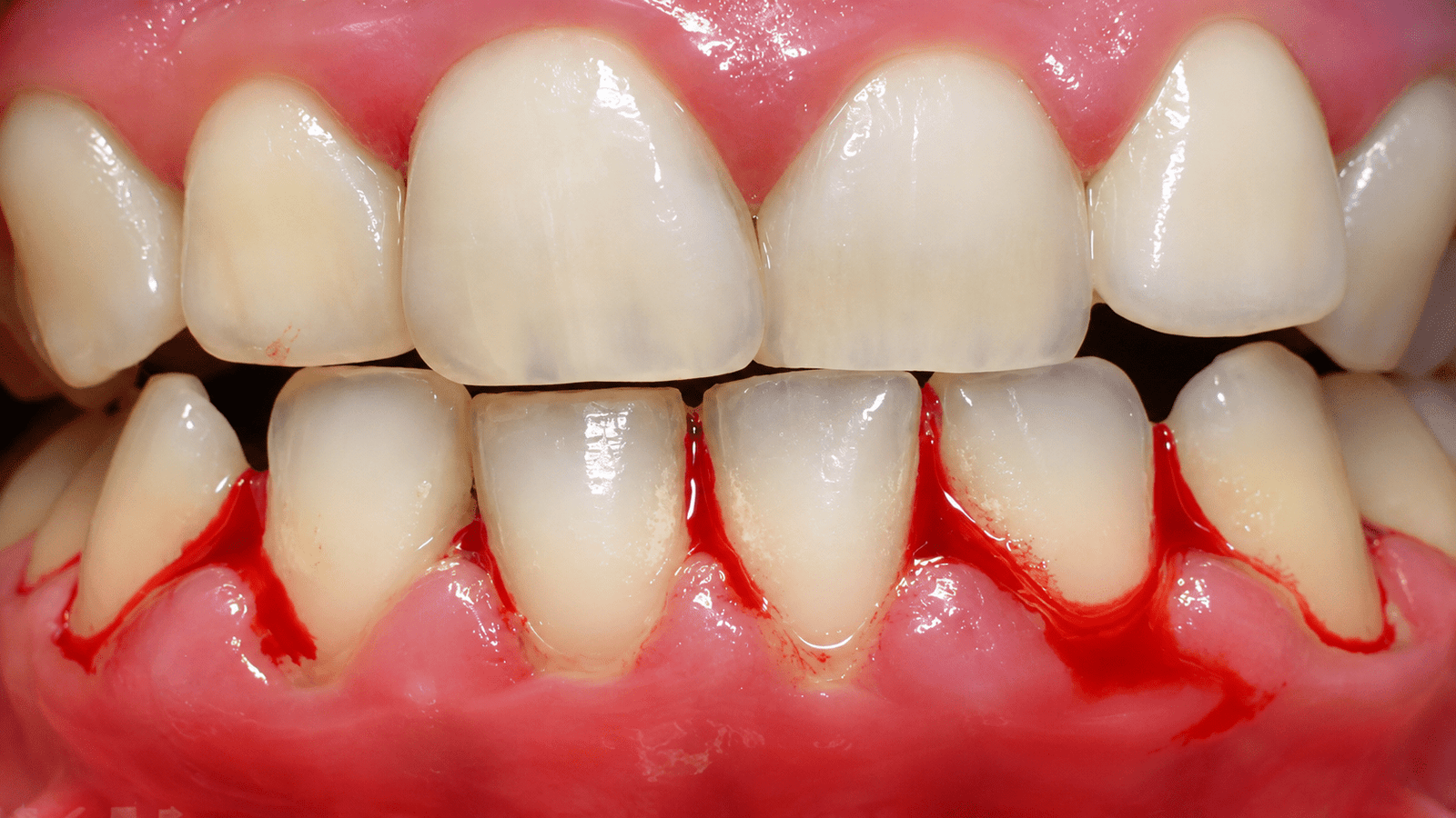 Gum disease and oral health research — watch now